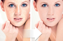 Photoshop Facial Surgery